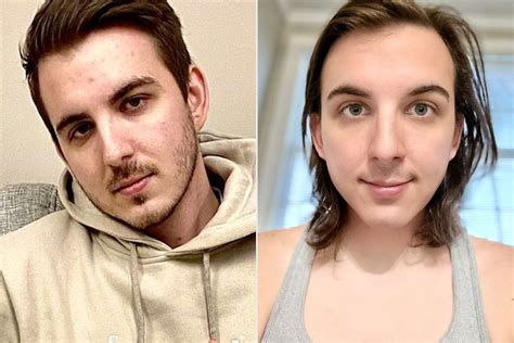 MrBeast YouTube Star Chris Tyson Started Hormone。